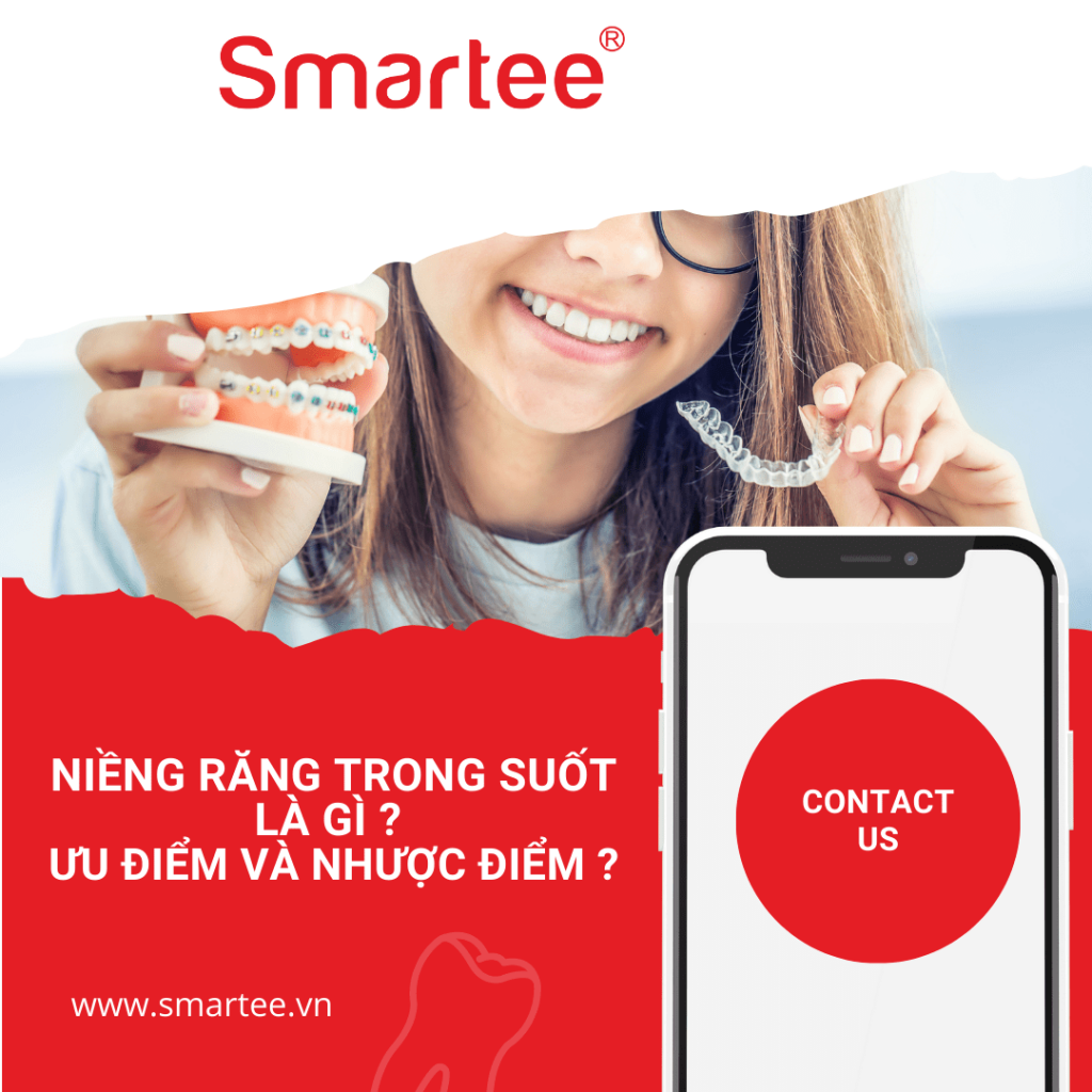 nụ cười rạng rỡ với niềng răng trong suốt 