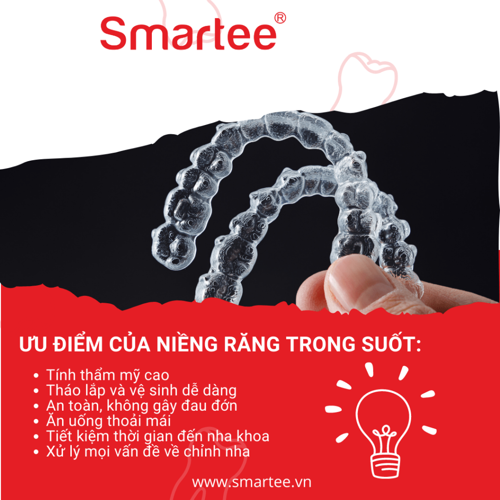 Mô tả ưu điểm của niềng răng trong suốt