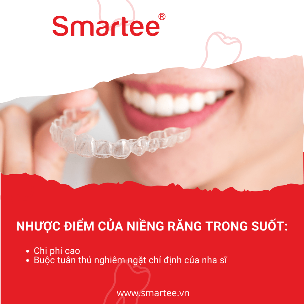 nhược điểm niềng răng trong suốt